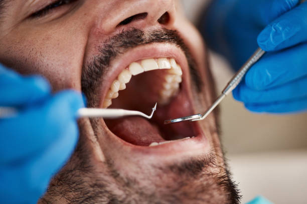 Best Emergency Tooth Extraction  in Hidden Valley, IN