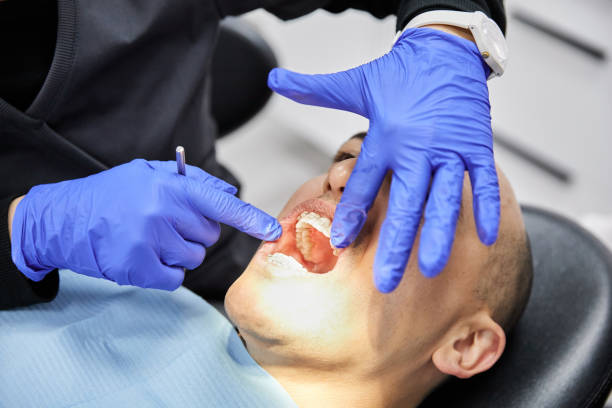 Best Teeth Whitening  in Hidden Valley, IN